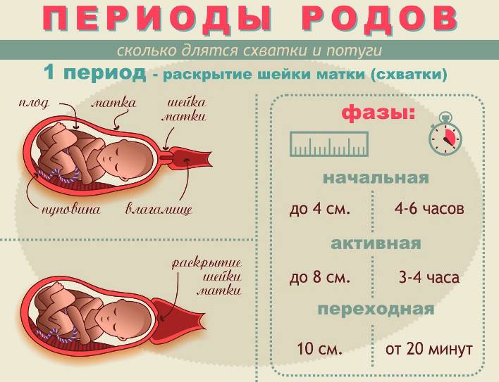 Что провоцирует роды