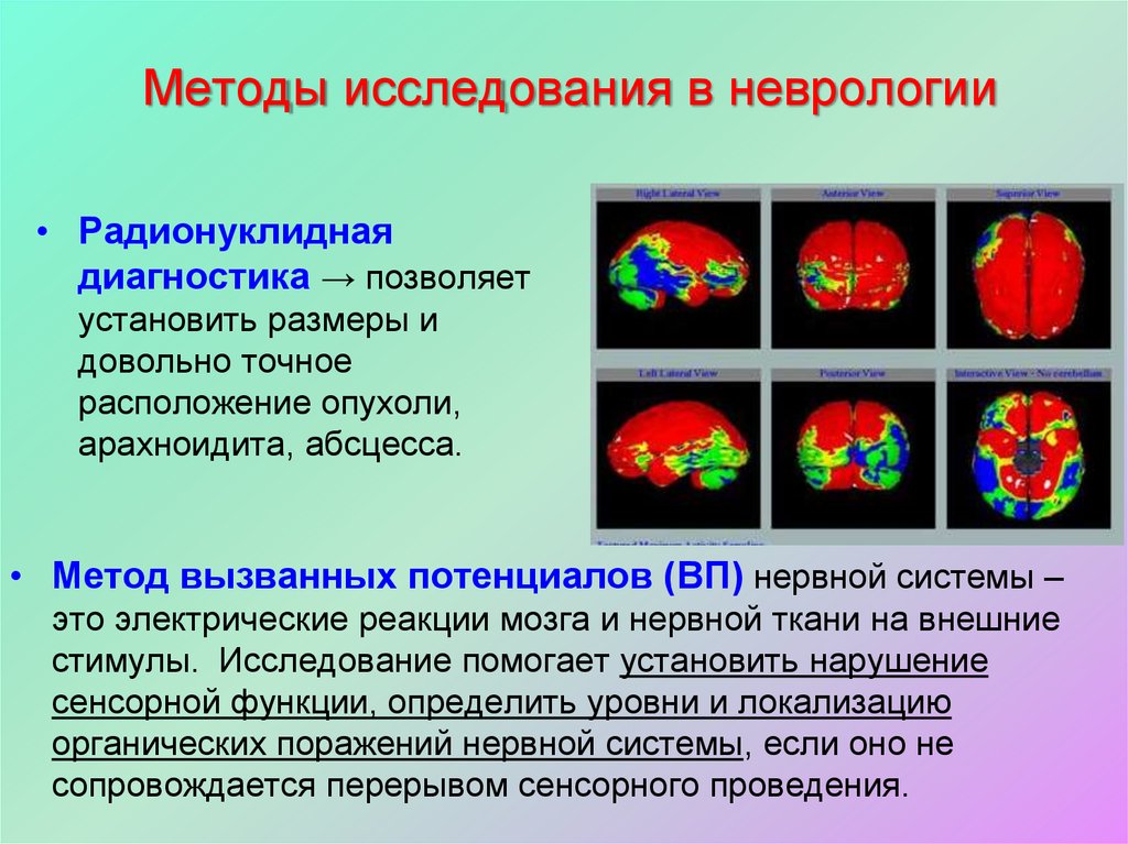 Методы исследования в неврологии презентация