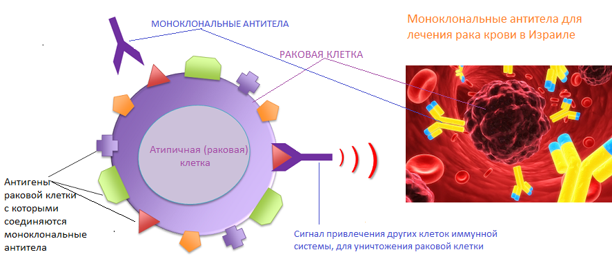 Лечение рака крови в израиле | медицинский центр хадасса