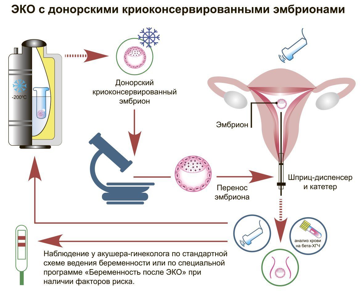 процедура введения спермы в матку фото 25