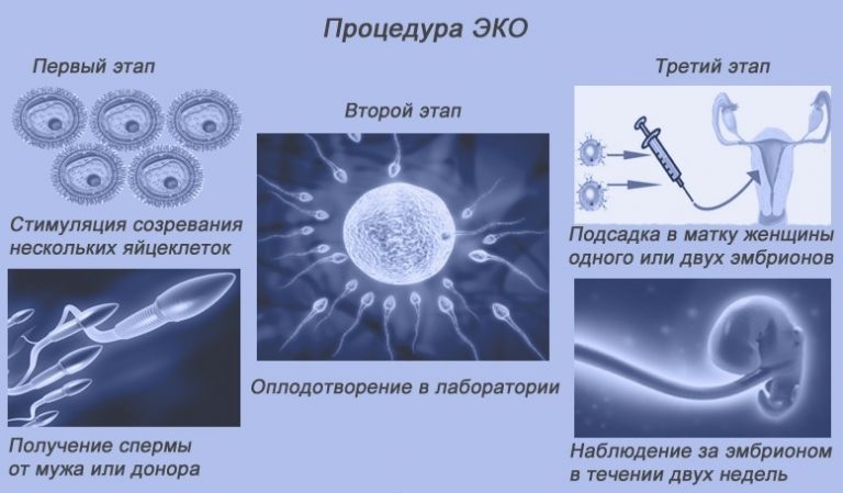 Эко в израиле: этапы, показатели эффективности, стоимость