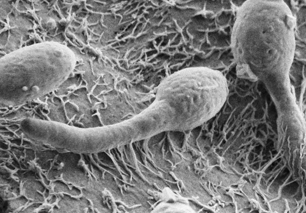 Грибки паразиты в организме человека: виды, симптомы и лечение