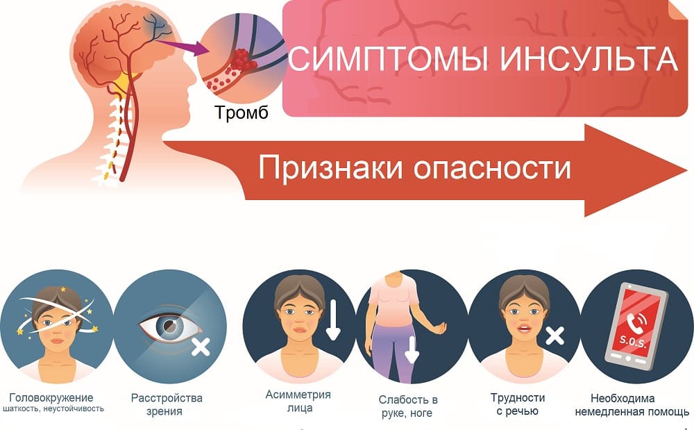 Головокружение: причины возникновения, симптомы и признаки