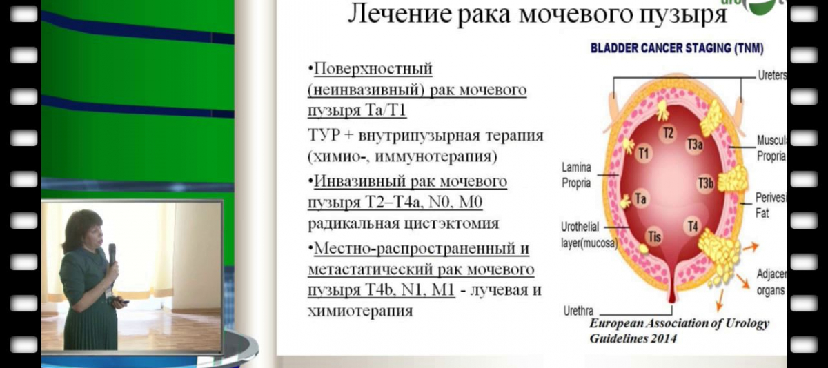 Лечение рака мочевого пузыря в германии: лучшие немецкие клиники